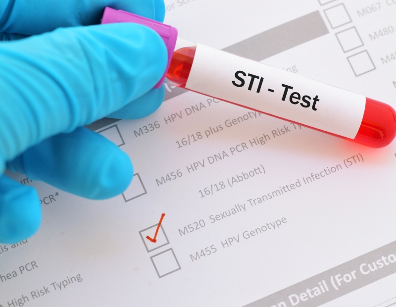 STD testing