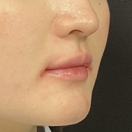 After