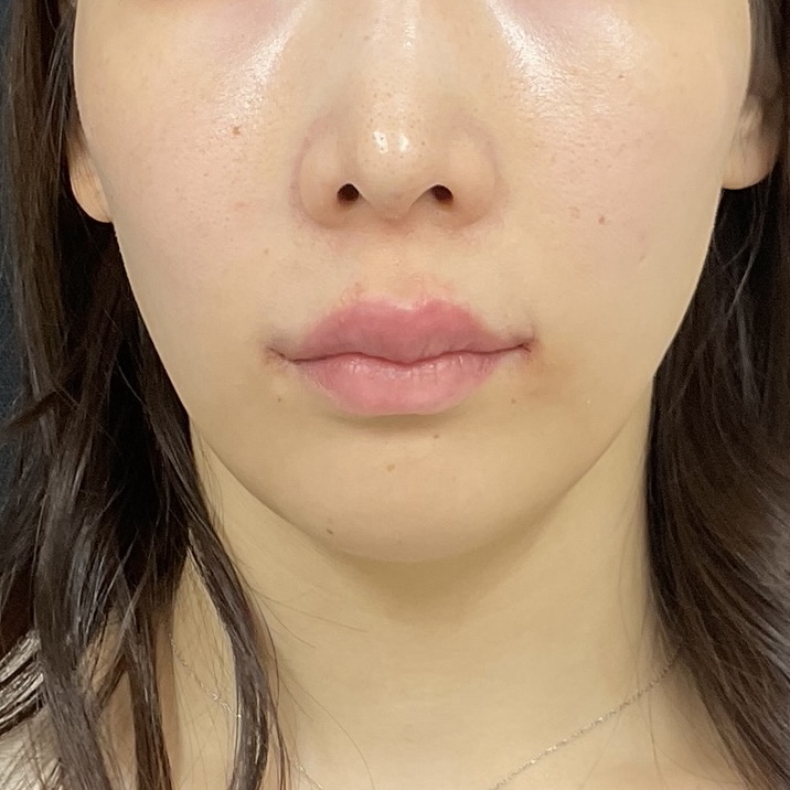 After