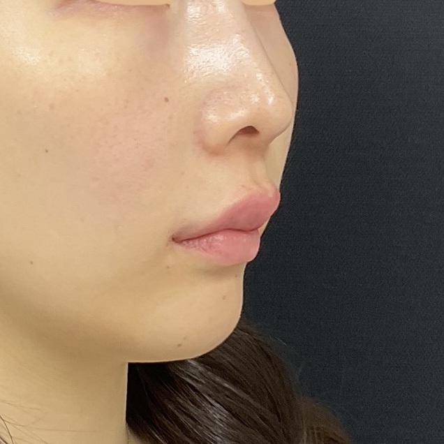 After