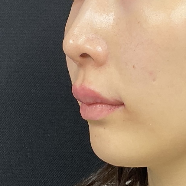 After