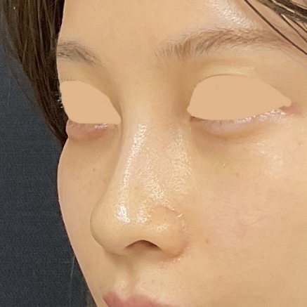 After