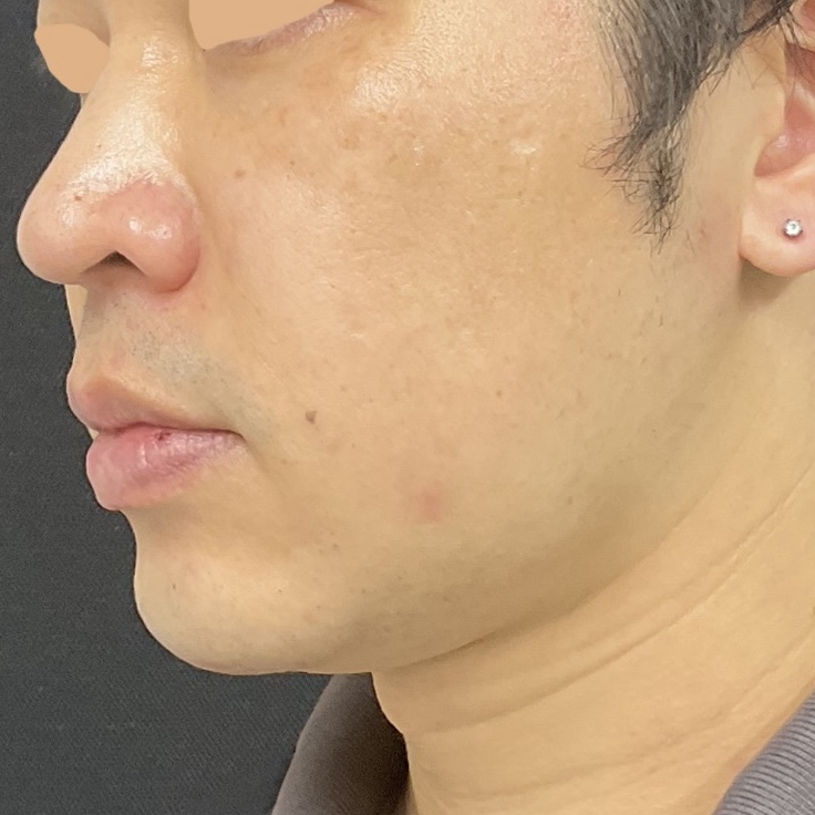 After