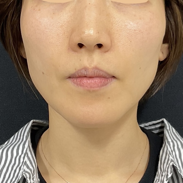 After