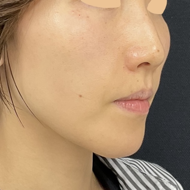 After