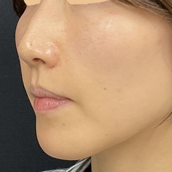 After