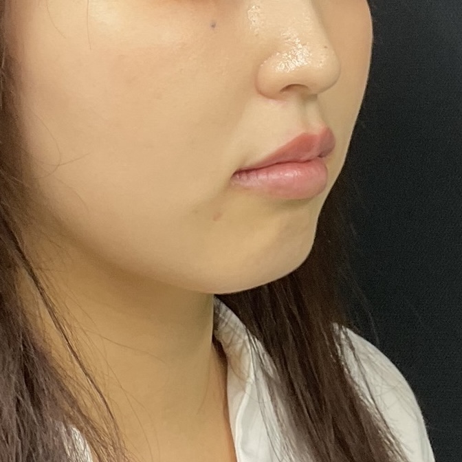 After