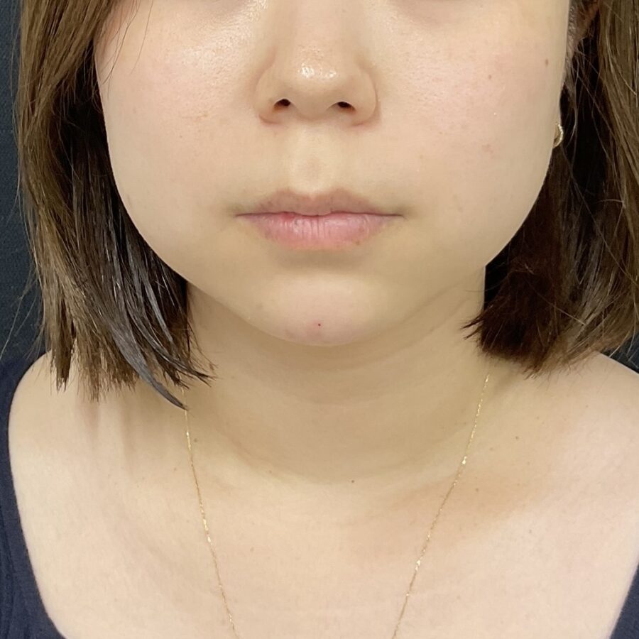 After