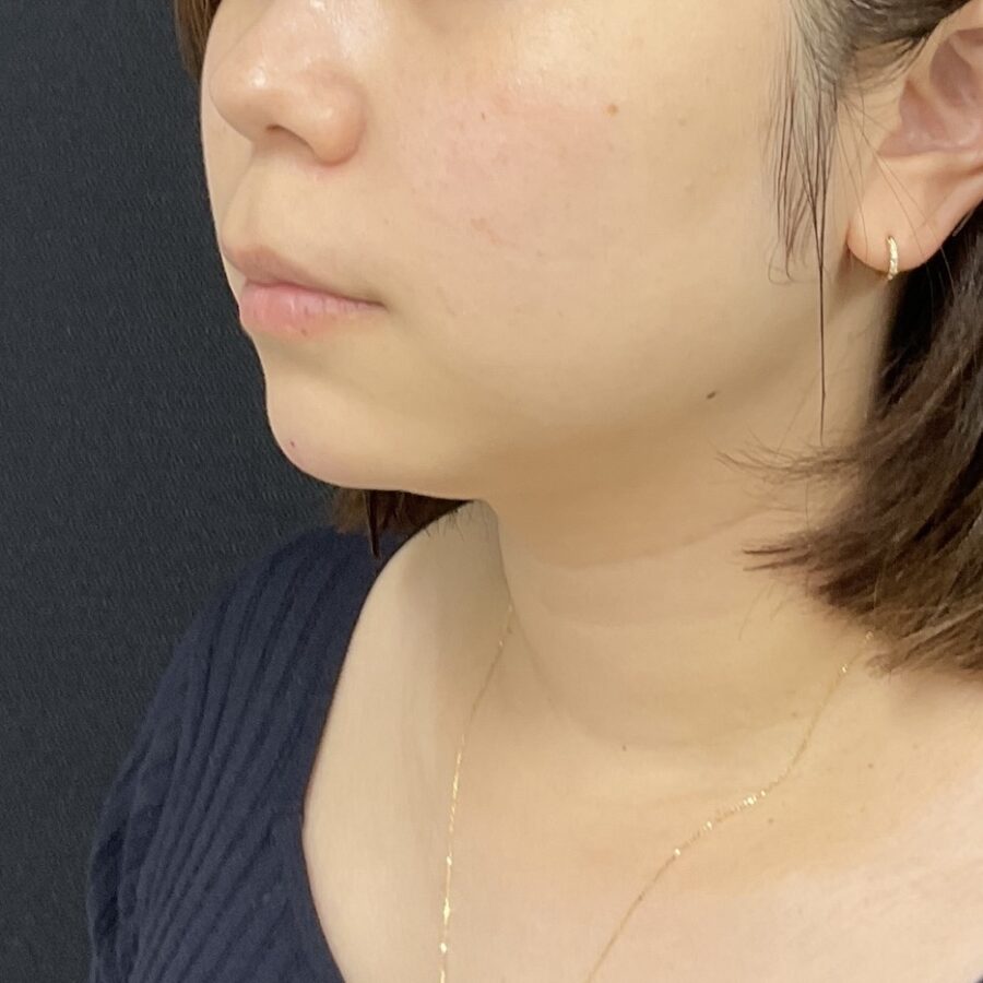 After