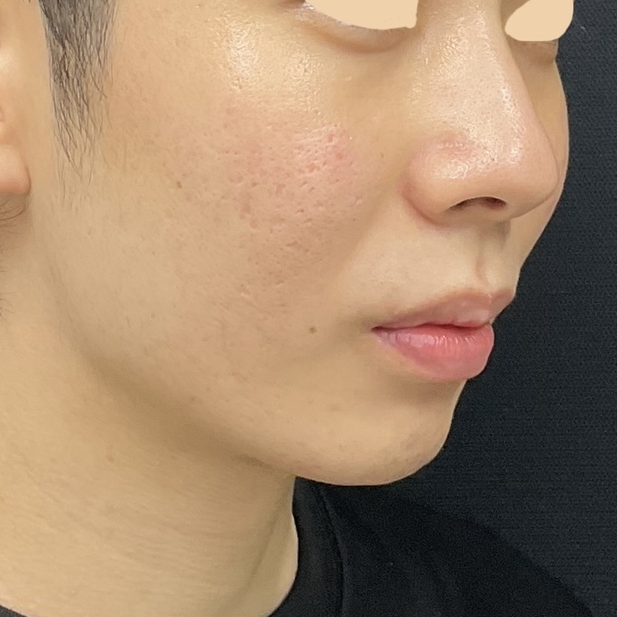 Before