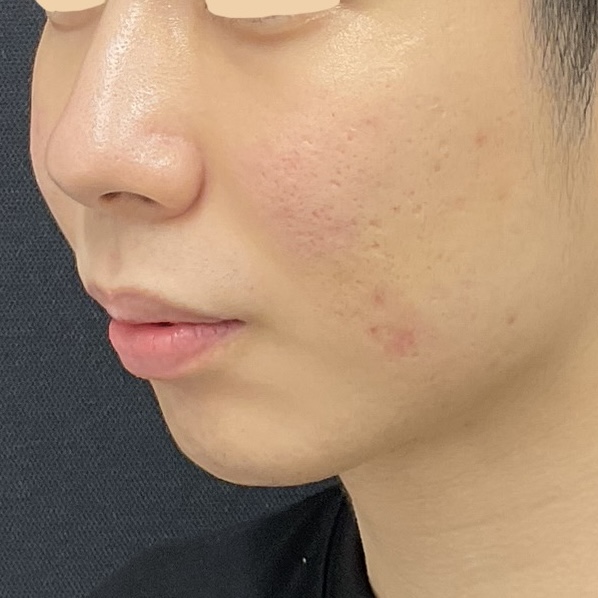 Before