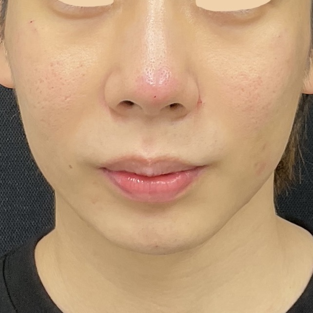 After