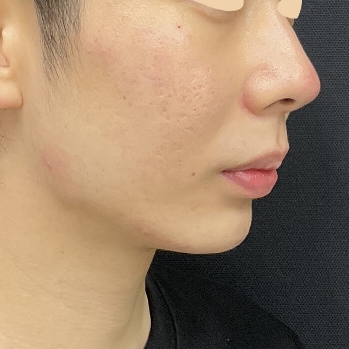 After
