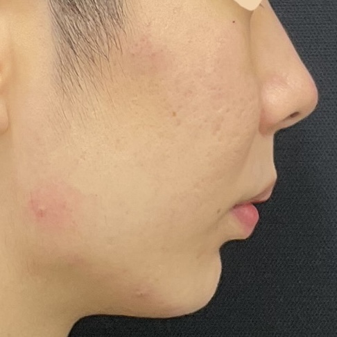 After
