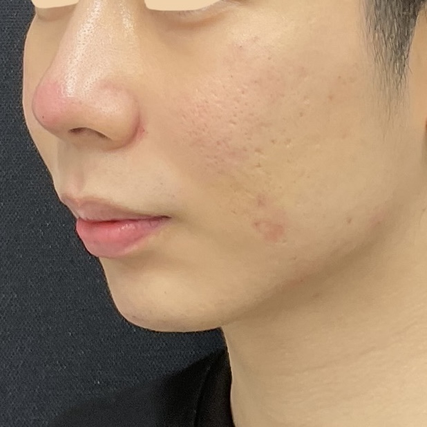 After