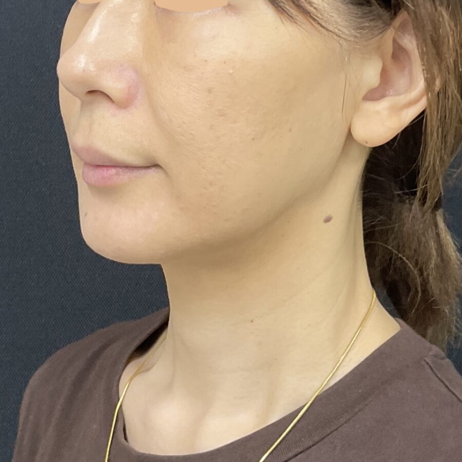 After
