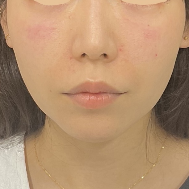 After
