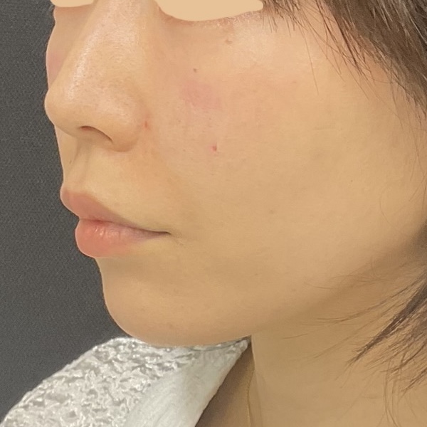 After