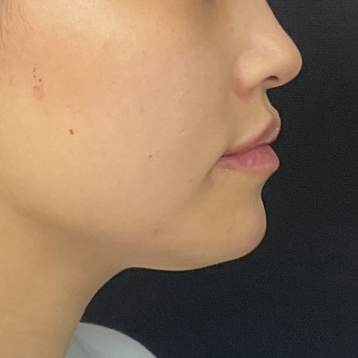 After