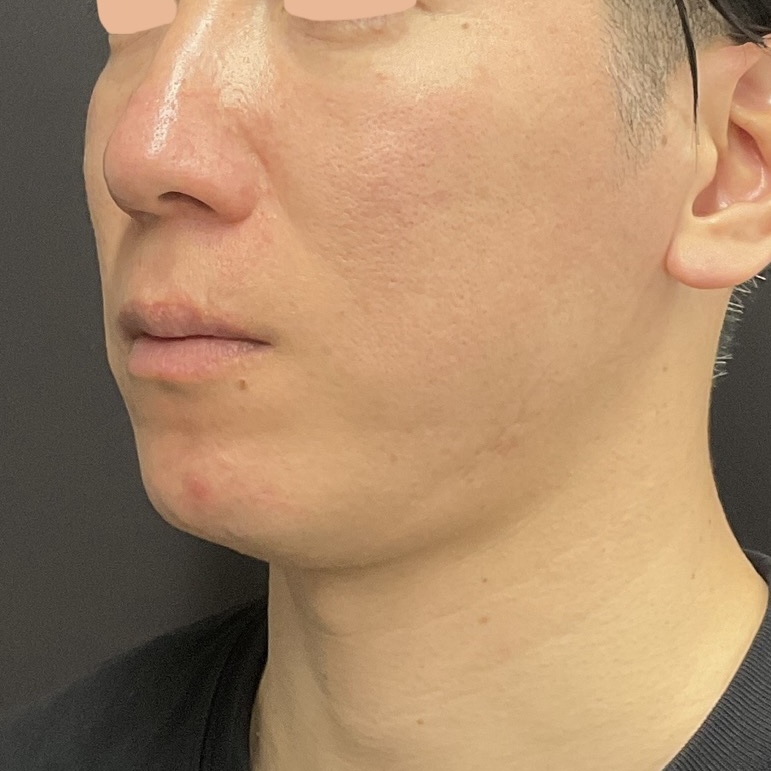 After