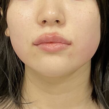 After