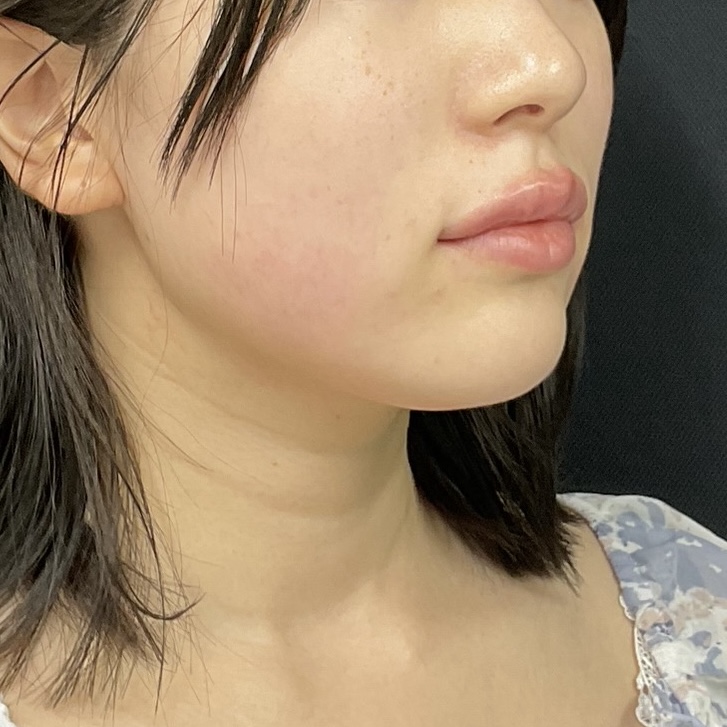 After
