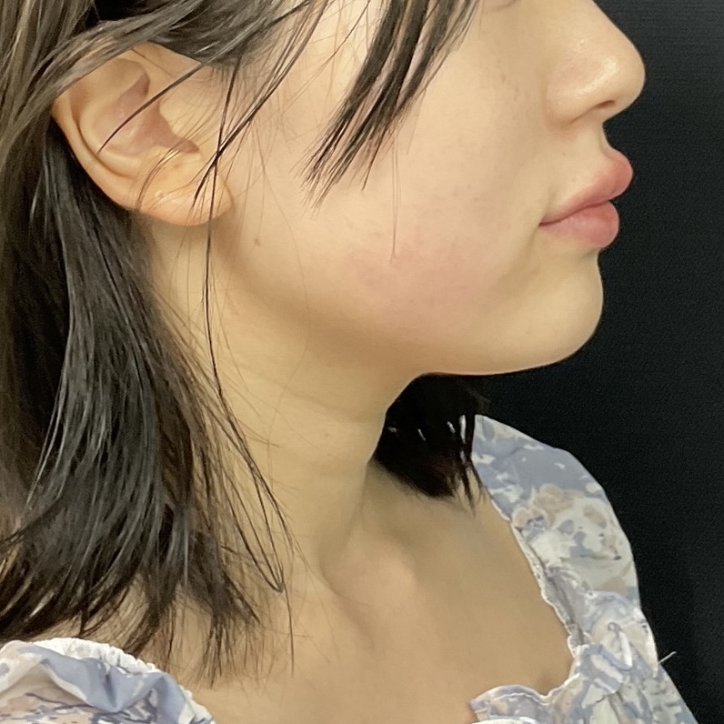 After