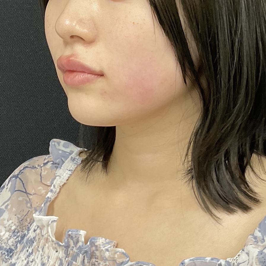 After