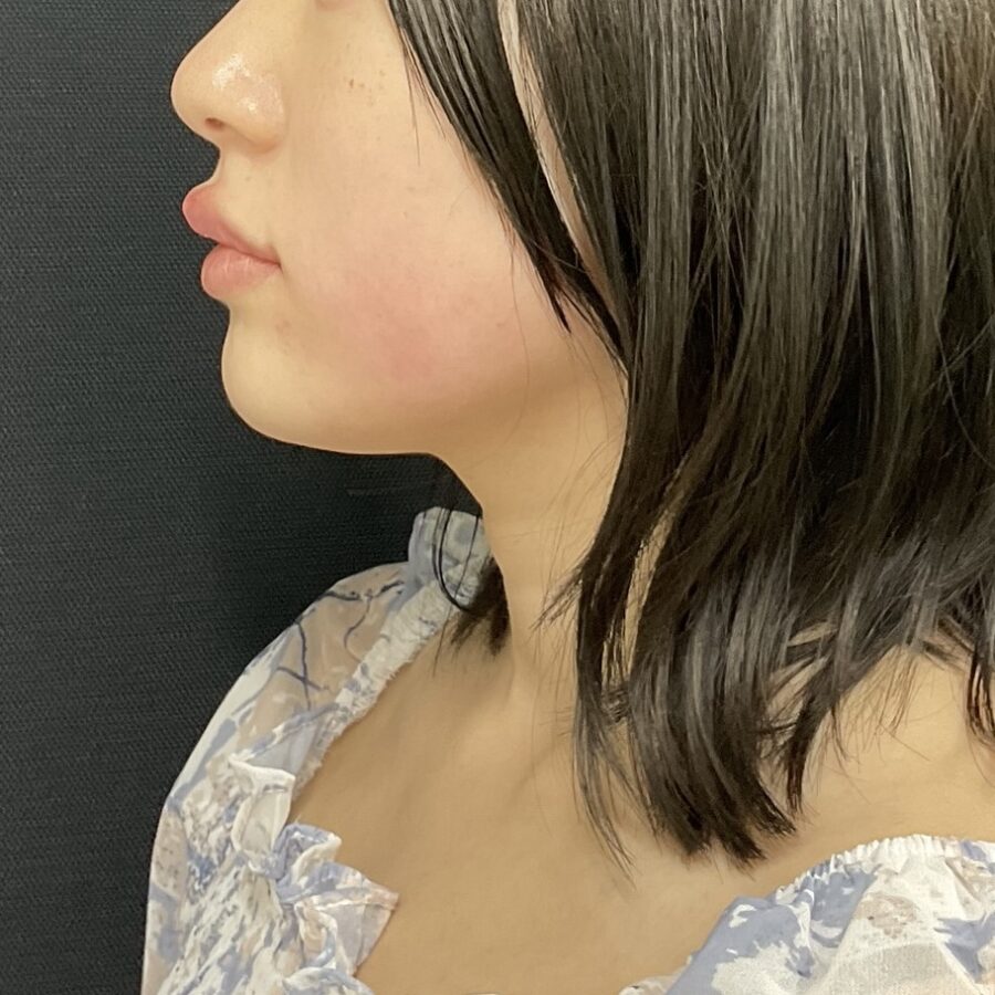 After