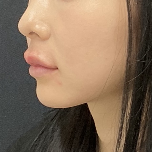 After