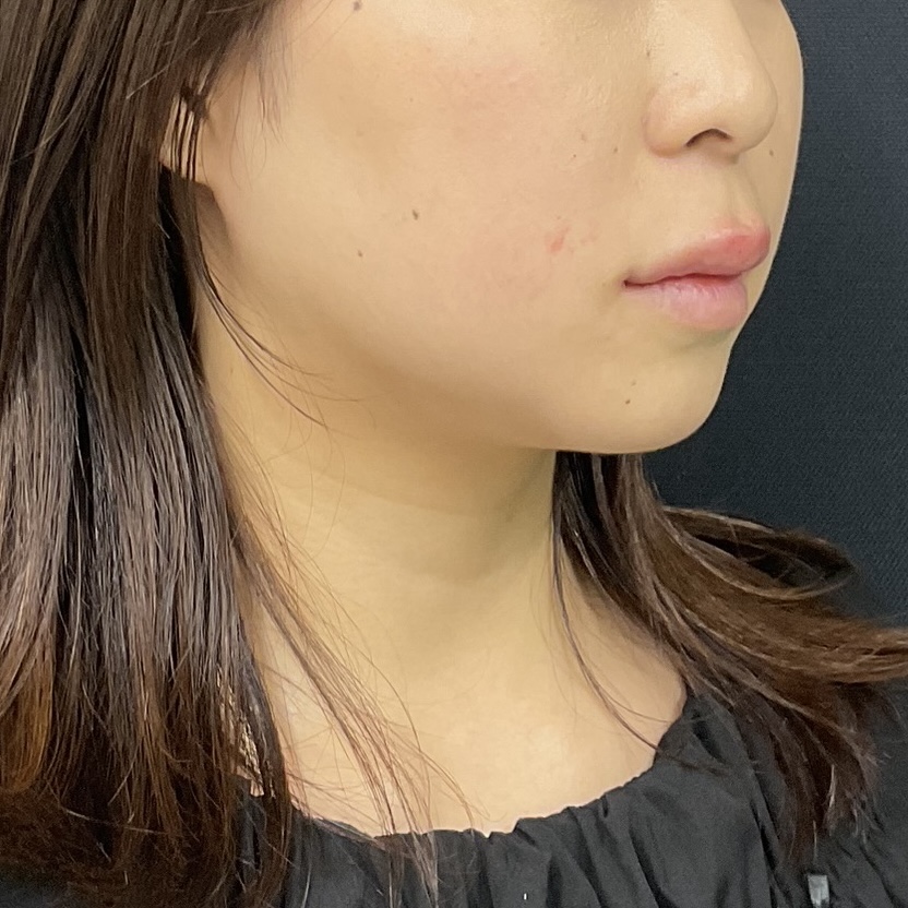 After