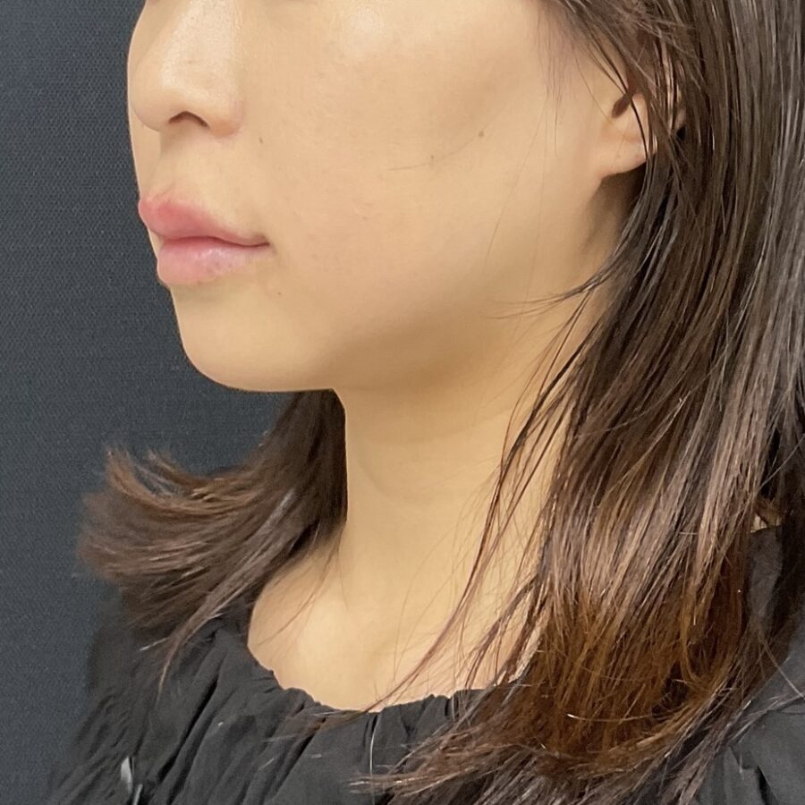 After
