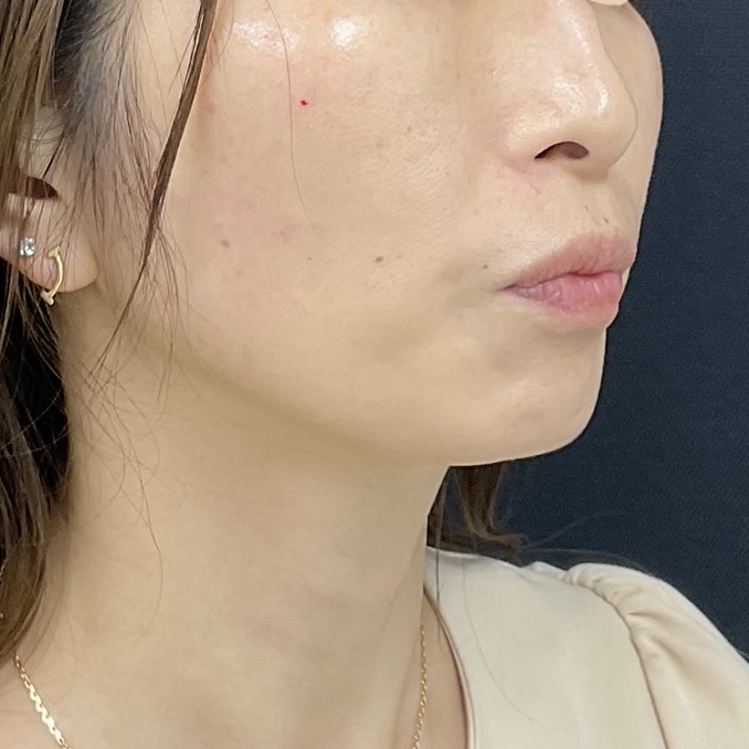 After