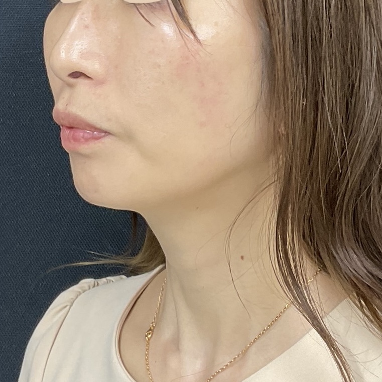 After