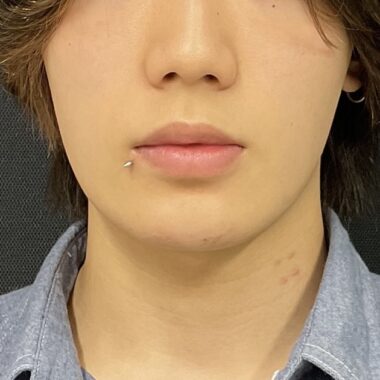 After