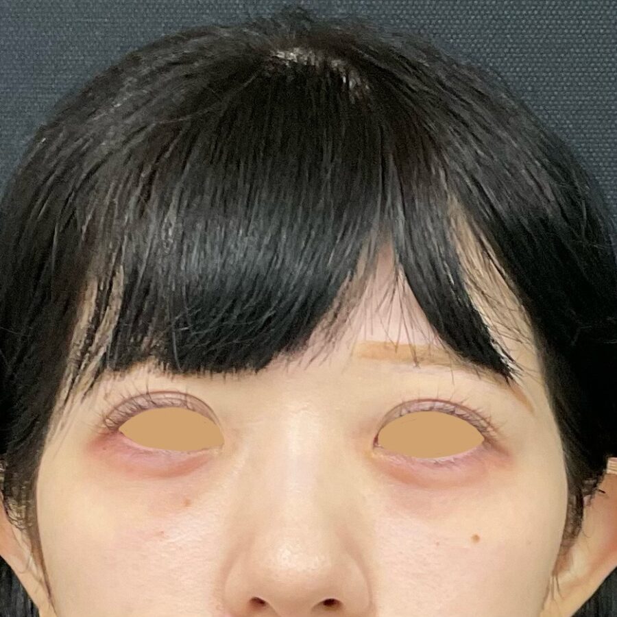 After