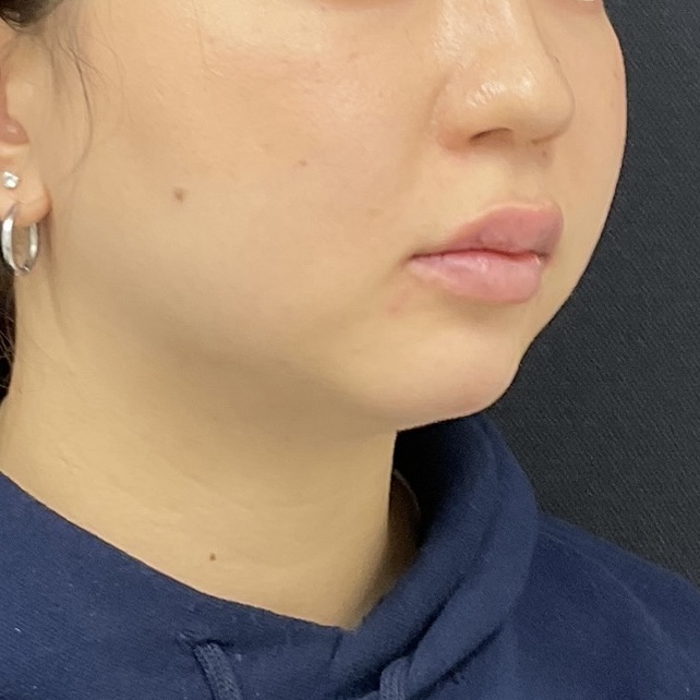 After