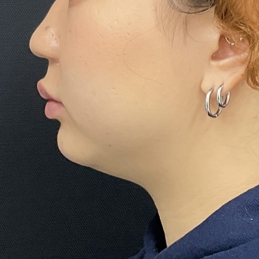 After