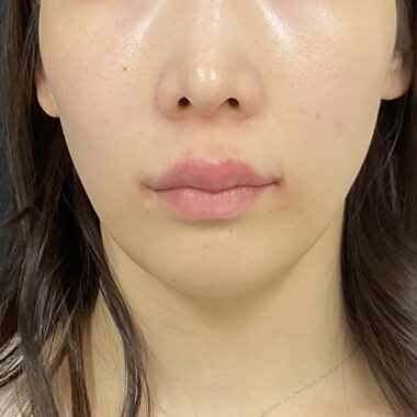 After