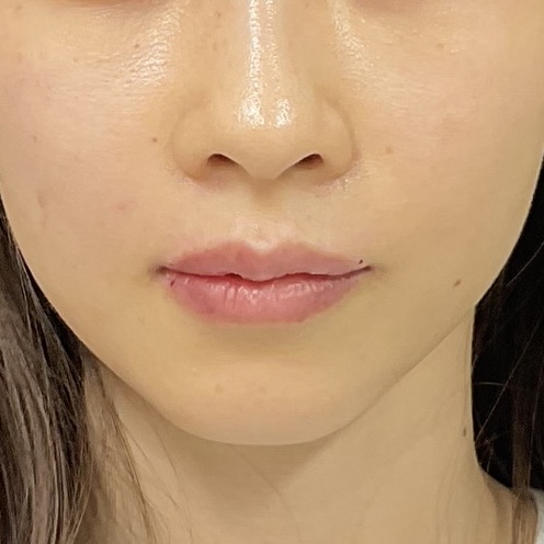 After