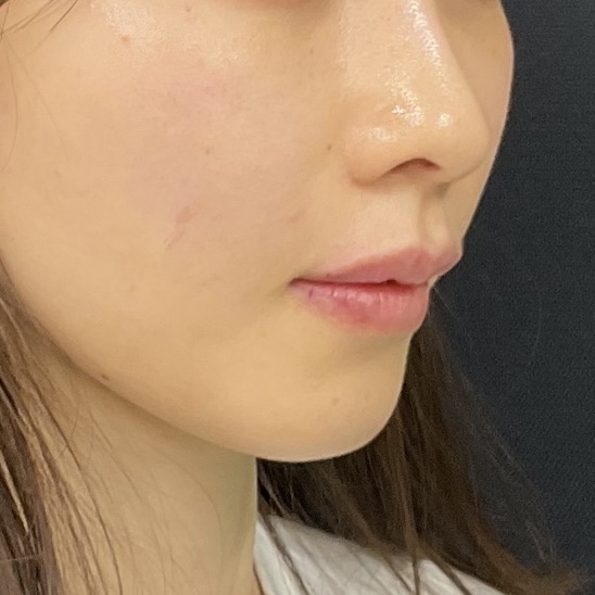 After