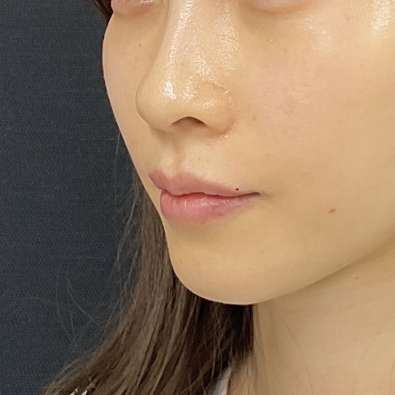 After