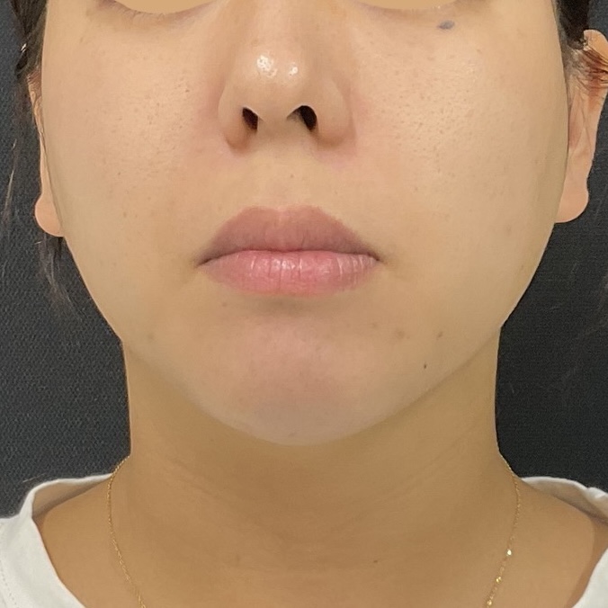 After