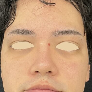 Before