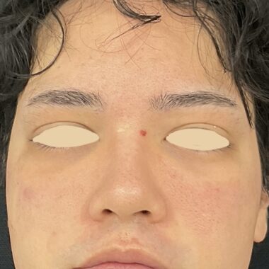 After