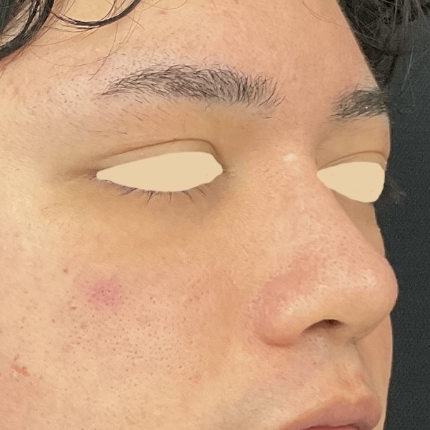 After