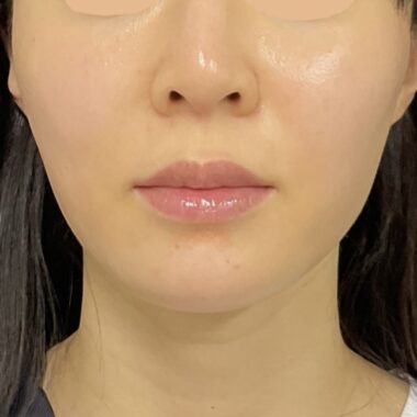 After