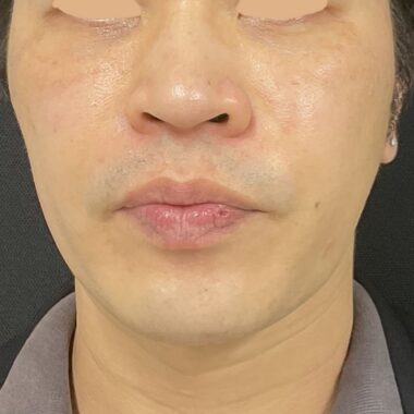 After