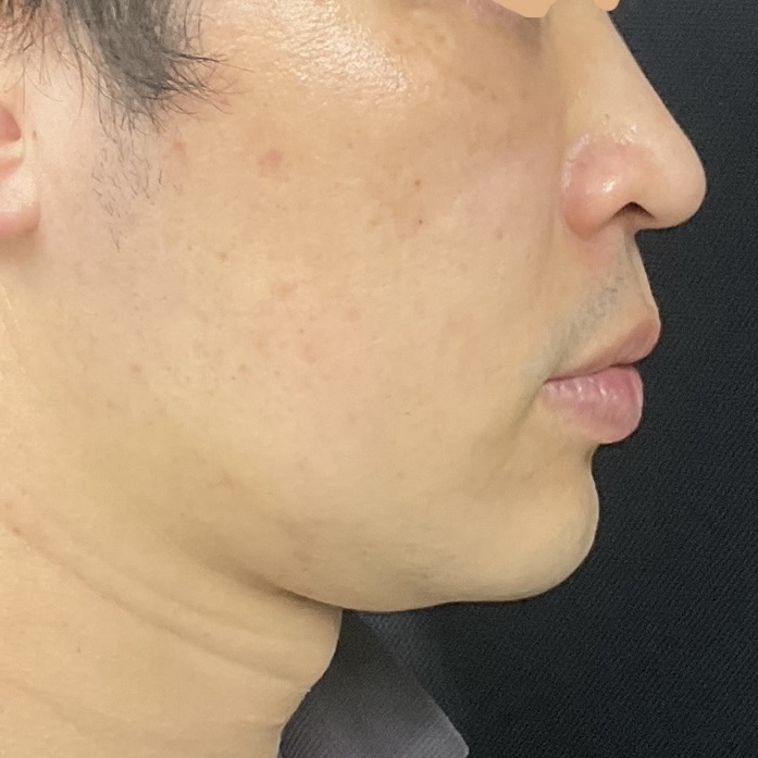After