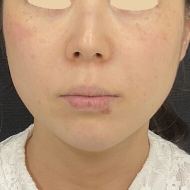 After